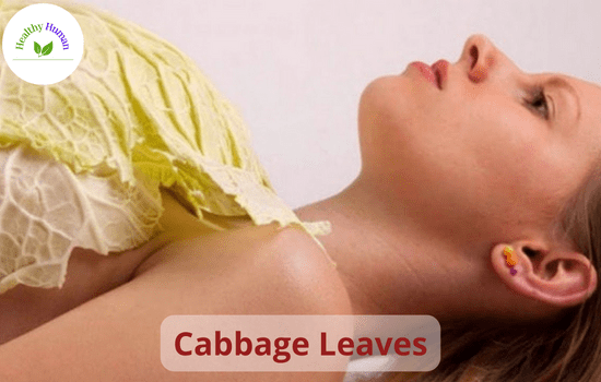 cabbage leave as a remedy