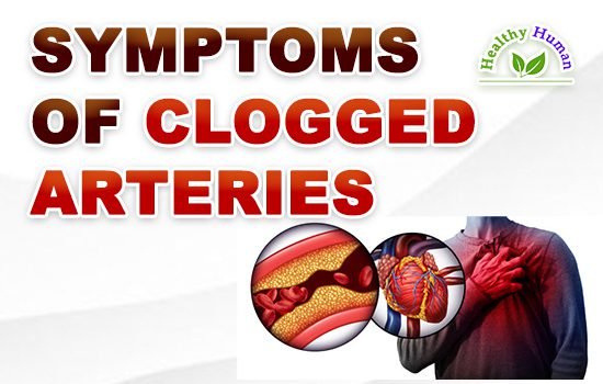 Symptoms of Clogged Arteries