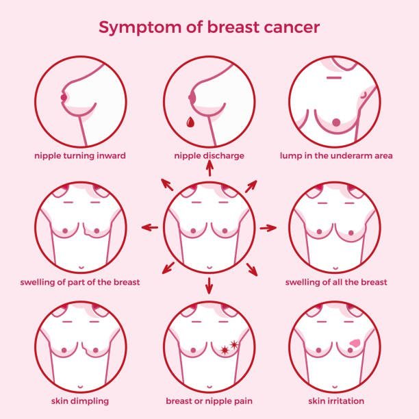 symptoms of breast cancer