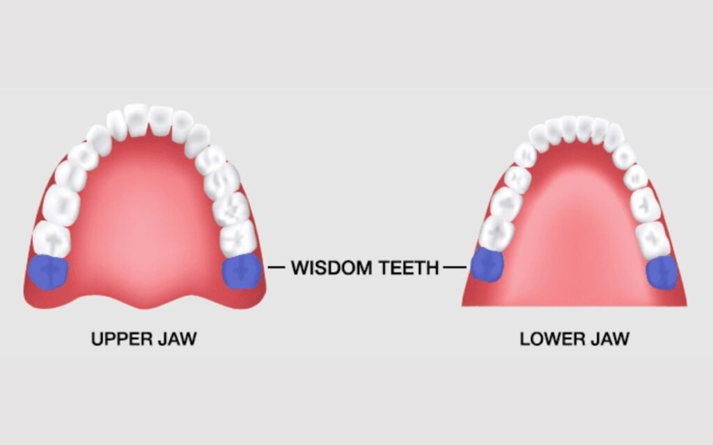 Benefits of wisdom teeth