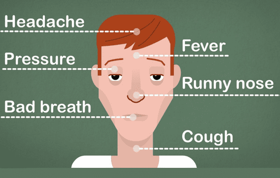 Symptoms of Sinus