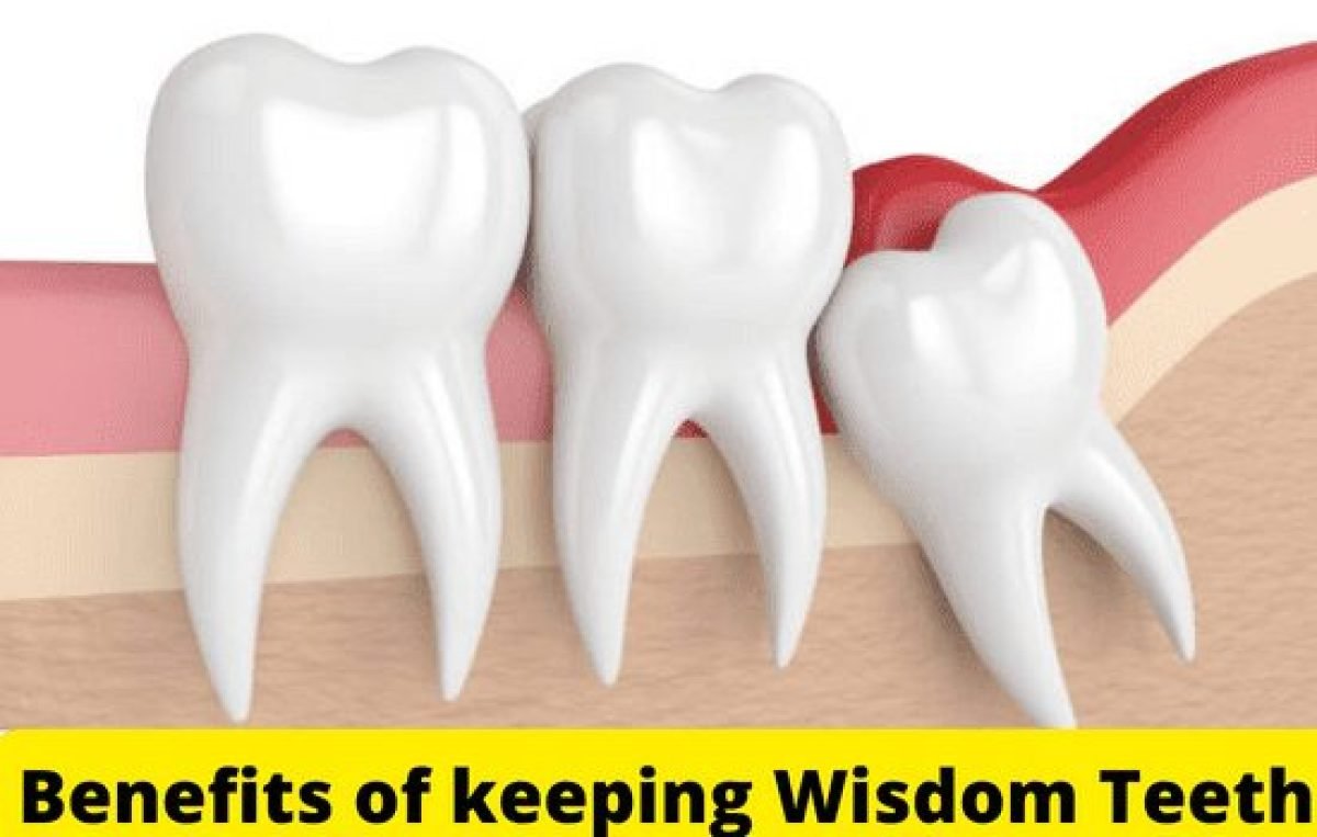 benefits of keeping wisdom teeth