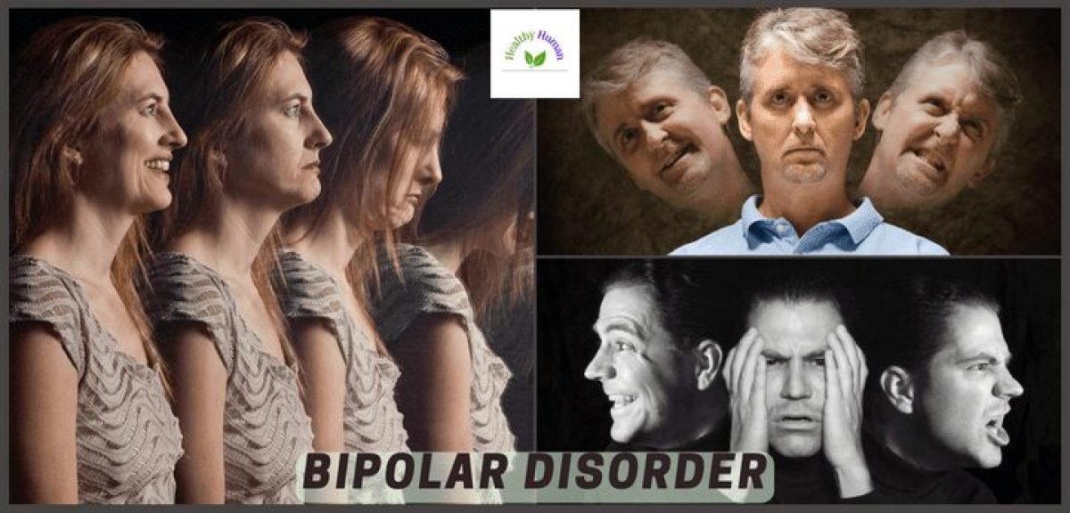 Bipolar disorder: causes & symptoms
