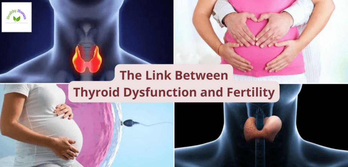 Thyroid dysfunction and fertility
