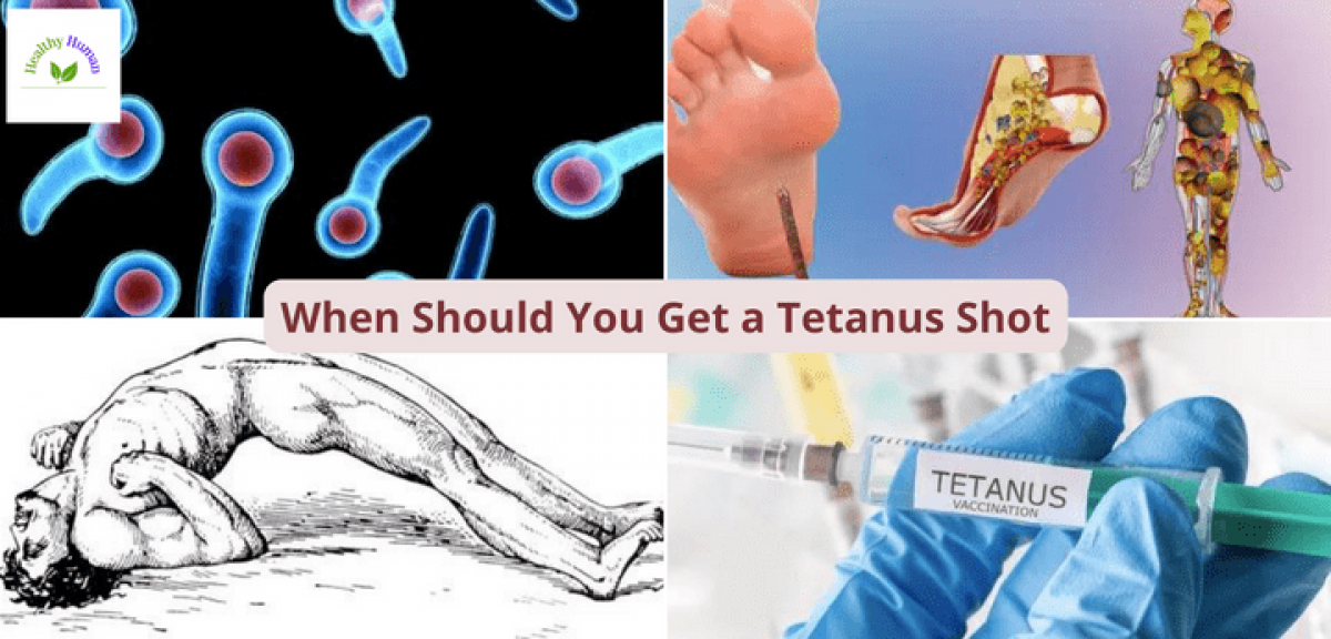 Tetanus