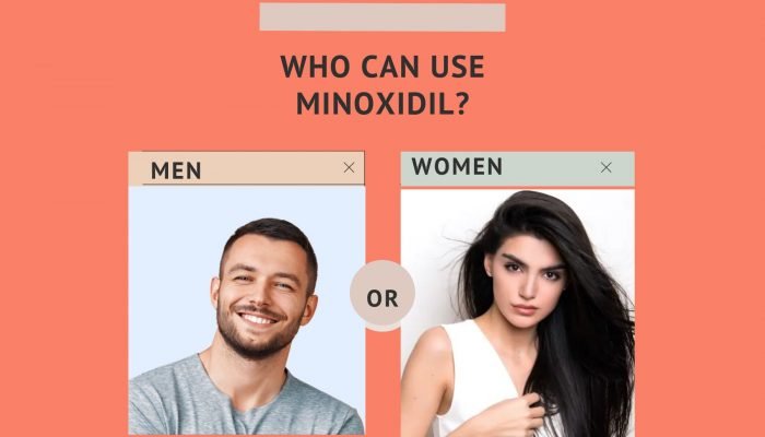 Who-Can-Use-Minoxidil