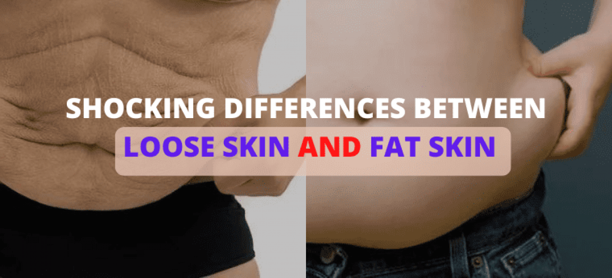 loose skin vs fat